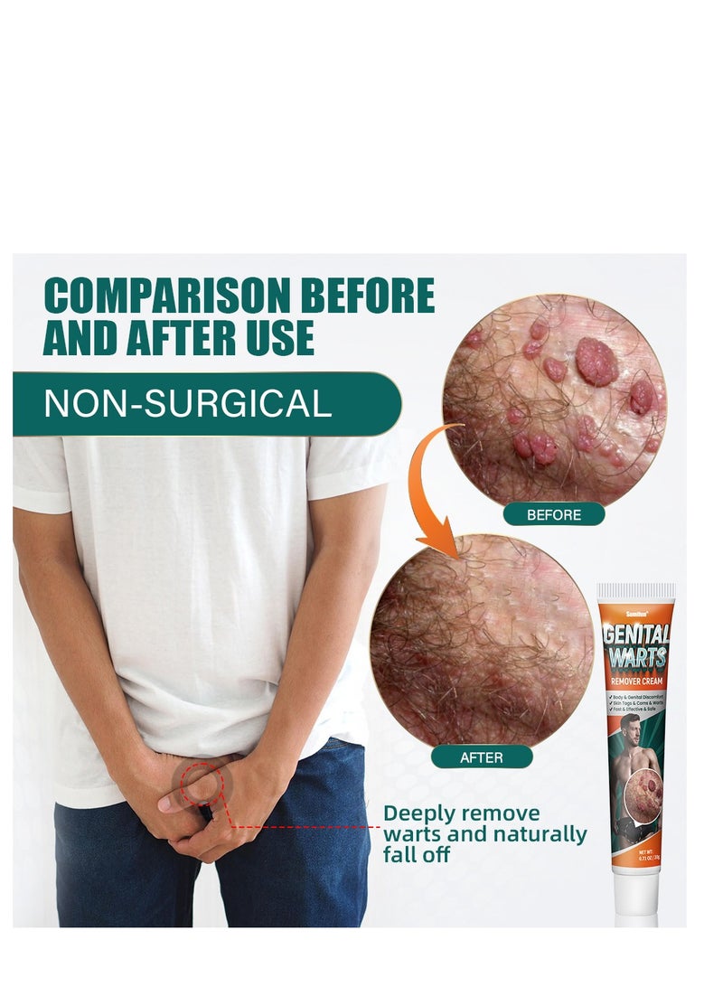 سوميفون كريم إزالة الثآليل، كريم لطيف وآمن وقابل للتنقل مع مستخلصات طبيعية لجميع أنواع البشرة، مناسب لكل من الرجال والنساء لإزالة الثآليل. حماية الصحة والجمال 20 جرام - Image 2