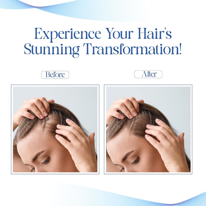 VCare Hair Growth Vitalizer For Frizzy Hair and Moisturize Dry Head Reduces Hair Fall Dandruff Control Serum Oil Free No Sulphate No Cruelty and No ParabenPack of 3100 ml - Image 4