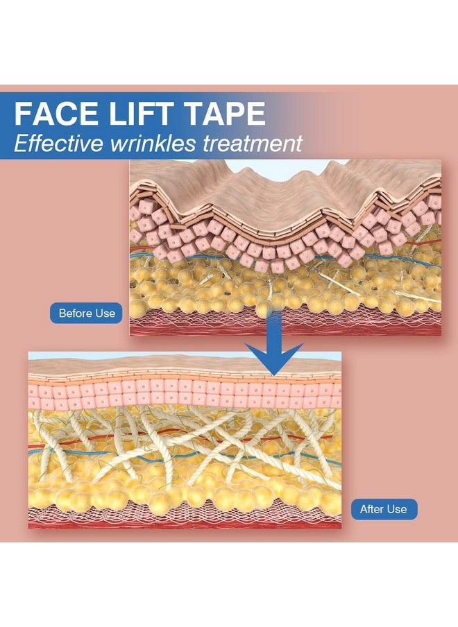 Face Tape For Wrinkles Face Wrinkle Tape Face Smoothing Patches V Face Self Care Products Face Tape Forehead Wrinkle Patches Reusable Chest Wrinkles Neck Patches 2.5Cm*1000Cm