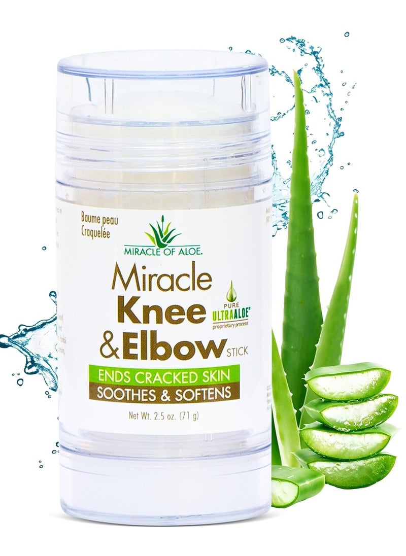 Miracle Knee & Elbow Stick with UltraAloe Gel for Dry, Cracked Skin, Soothes, Moisturizes, Promotes Healing, 2.5 oz - pzsku/Z2247EBB405D52E97C2B5Z/45/1741424069/6aeac638-1f12-4c73-b17e-7bd36183b222