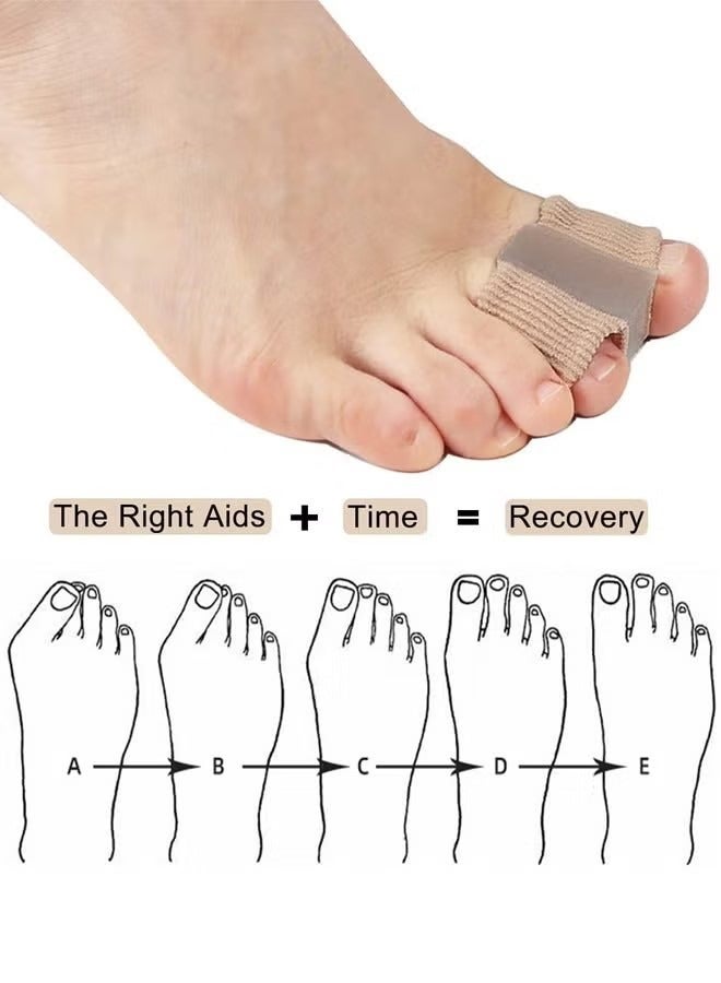 4Pcs Gel Toe Separators, Overlapping Bunion Corrector, Silicone Toe Separators with Soft Gel Pad Pain Relief Bunion Bunion Corrector, Nylon Silicone, One Size - Image 2