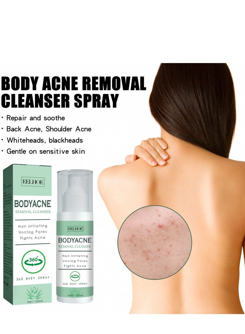 EELHOE Body Spray, Back Acne Treatment, Back & Body Exfoliating Acne Spray, Smooth Skin, Back Moisturise, Acne Treatment for Bacne, Blackheads & Blemishes 120ml  - Image 3