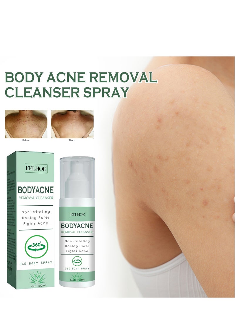 EELHOE Body Spray, Back Acne Treatment, Back & Body Exfoliating Acne Spray, Smooth Skin, Back Moisturise, Acne Treatment for Bacne, Blackheads & Blemishes 120ml  - Image 2