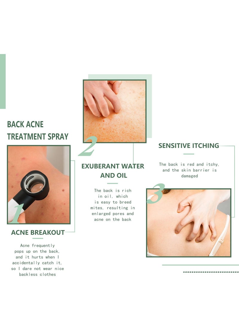 EELHOE Body Spray, Back Acne Treatment, Back & Body Exfoliating Acne Spray, Smooth Skin, Back Moisturise, Acne Treatment for Bacne, Blackheads & Blemishes 120ml  - Image 4