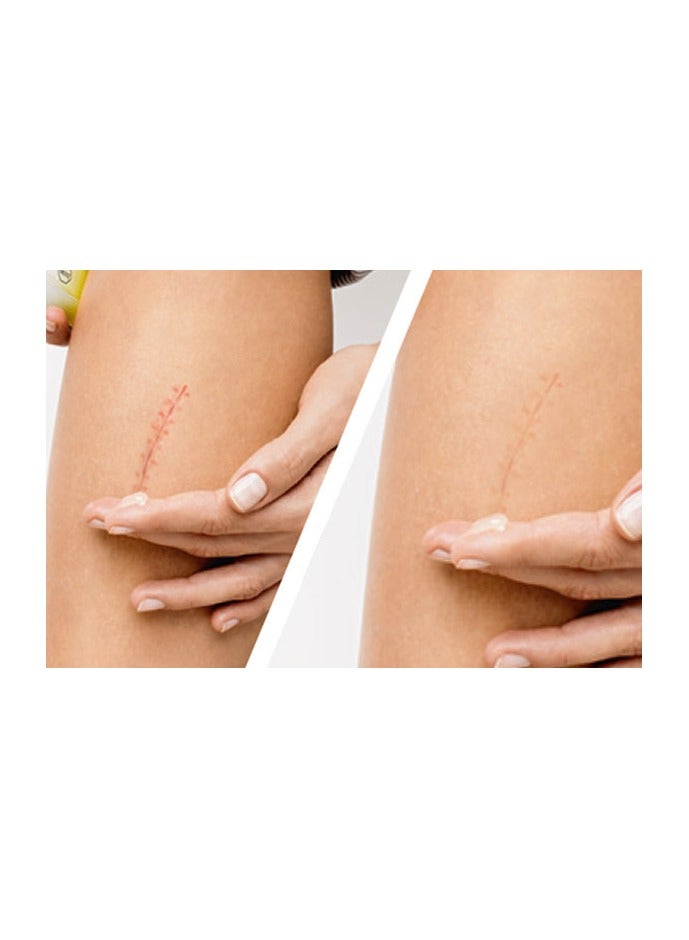 كونتراكتيوبكس جل 50 جم - Image 3