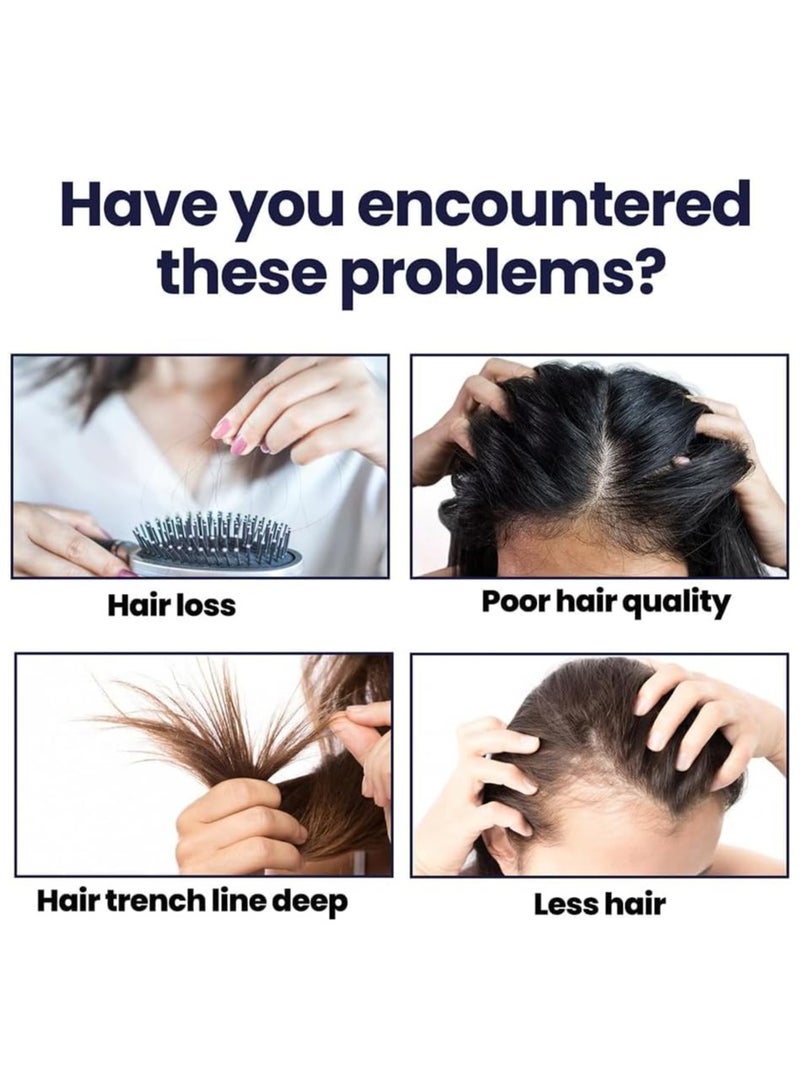 OUHOE 2Pcs Hair Growth Spray (50ml x 2) Hair Growth Oil Spray for Dry Damaged Hair and Growth Hair Scalp Oil Pure and Natural Hair Growth Serum Spray Hair Loss Treatment Oil Beard Growth Spray - Image 4