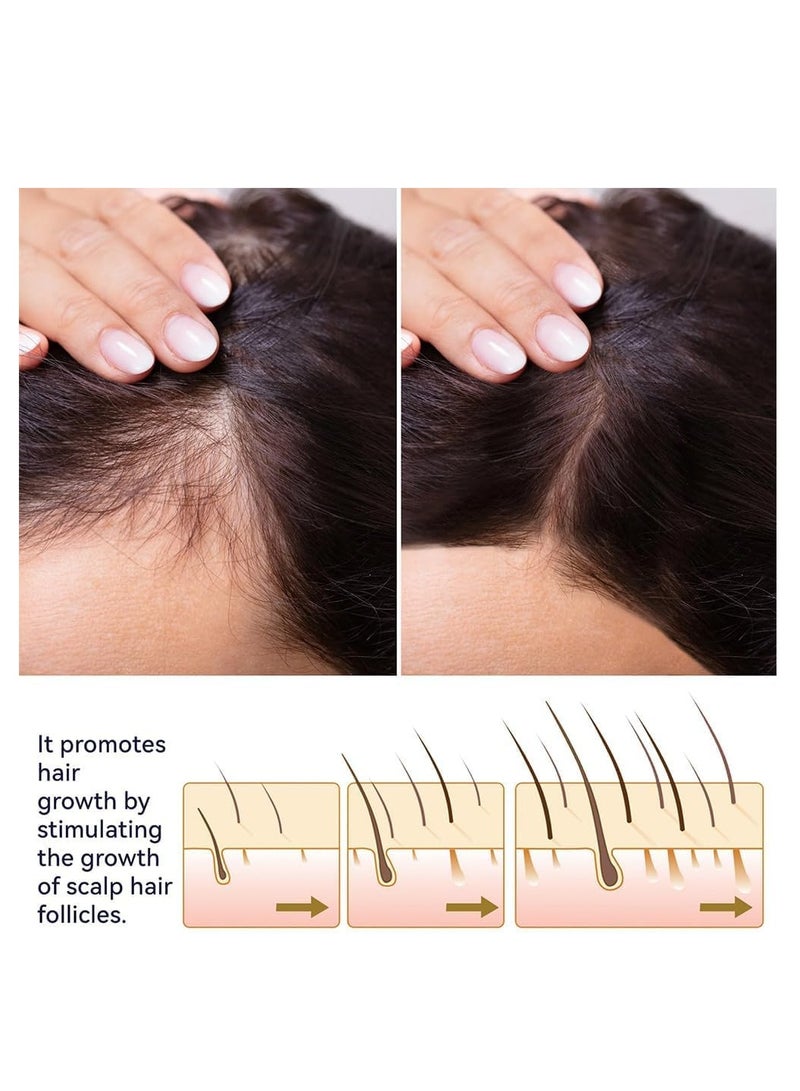 OUHOE 2Pcs Hair Growth Spray (50ml x 2) Hair Growth Oil Spray for Dry Damaged Hair and Growth Hair Scalp Oil Pure and Natural Hair Growth Serum Spray Hair Loss Treatment Oil Beard Growth Spray - Image 3