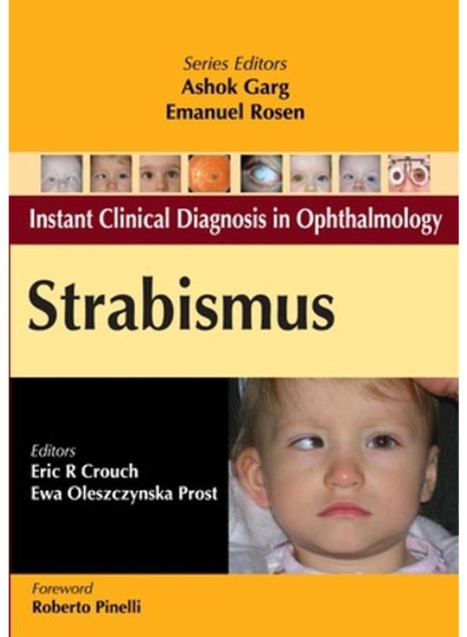 الحول (تشخيص سريري فوري في طب العيون)