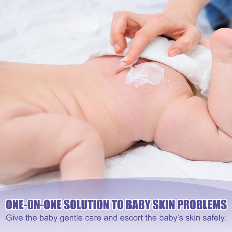 Diaper Rash Cream 30ml Gentle Formula Baby Cream - Soothing Relief Moisturizing Cream for Delicate Baby Skin - Image 2
