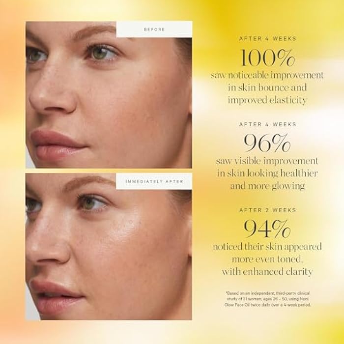 KORA Organics Noni Glow Hydrating Face Oil with Antioxidants, Nourish & Illuminate, Certified Organic, Cruelty Free, 0.34 fl oz - Image 4