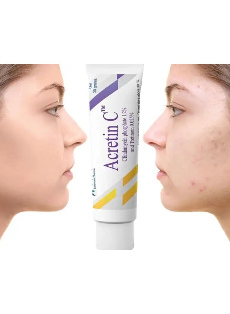 ACRETIN C Gel 30Grams - Image 2