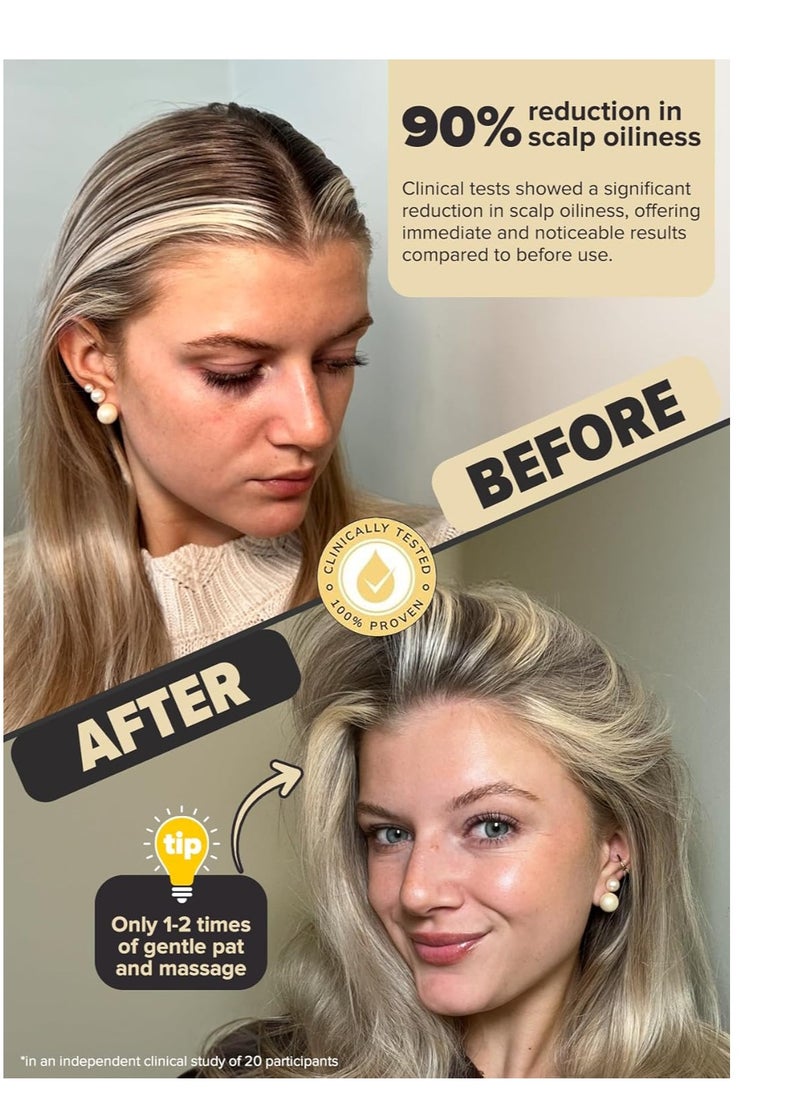 I DEW CARE - I DEW CARE Dry Shampoo Powder - Tap Secret | With Black Ginseng, Non-aerosol, Benzene-free, Mattifying Root Boost, No White Cast, Travel Size Dry Shampoo for Woman, Hair Care, 0.24 oz. - Image 1