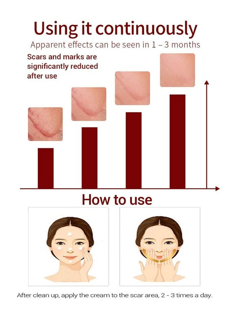 LANBENA - LANBENA Scar Removal Stretch Marks Cream Fade Acne and Pocks Soften Scars Resulting from Surgery, Injury, Burns and Scar Skin Repair Gel for Face & Body 40 g - Image 1