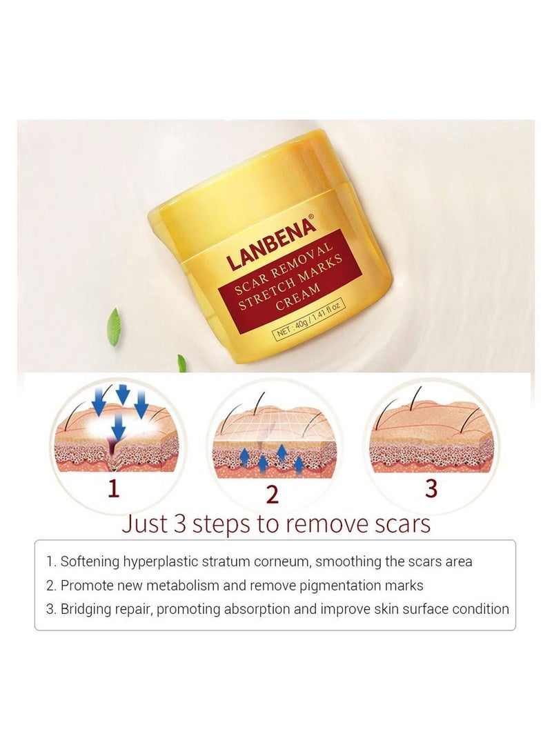 LANBENA - LANBENA Scar Removal Stretch Marks Cream Fade Acne and Pocks Soften Scars Resulting from Surgery, Injury, Burns and Scar Skin Repair Gel for Face & Body 40 g - Image 1