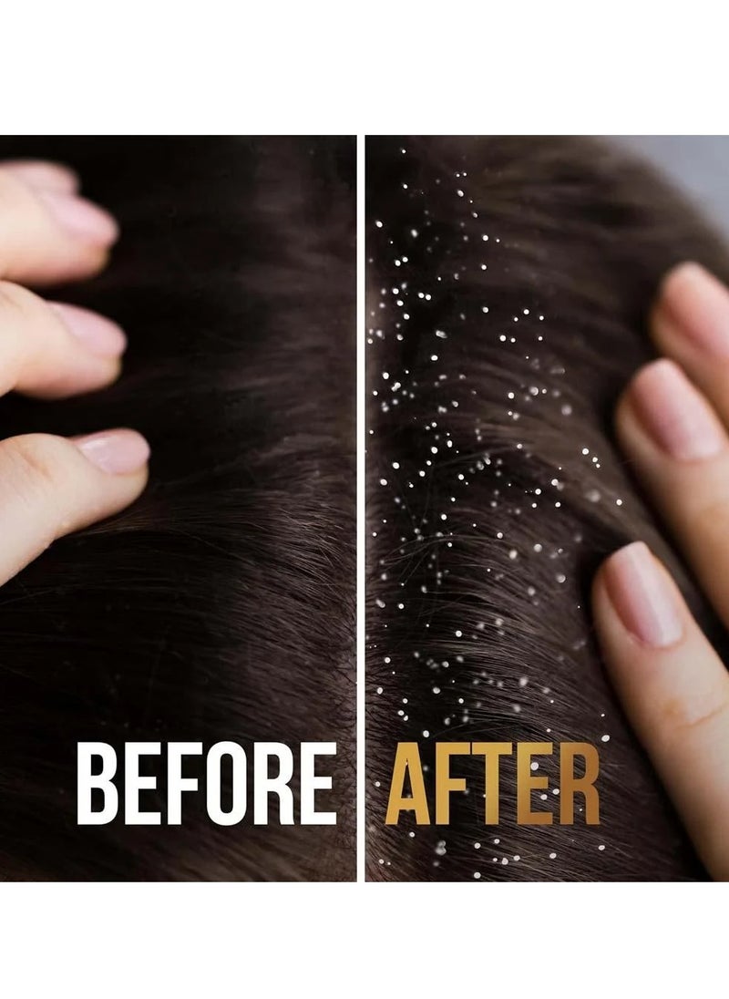Anti-Dandruff Shampoo 2 in 1 390 ml
