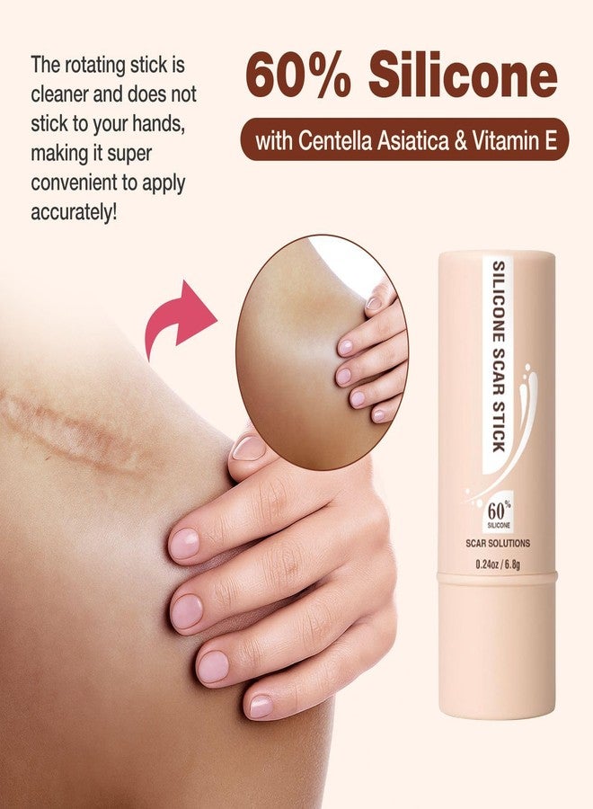 Wismee 2pcs Silicone Scar Stick, Made of 60% Silicone,Reduces the Appearance of Scars,Gentle on All Skin Types - Image 3