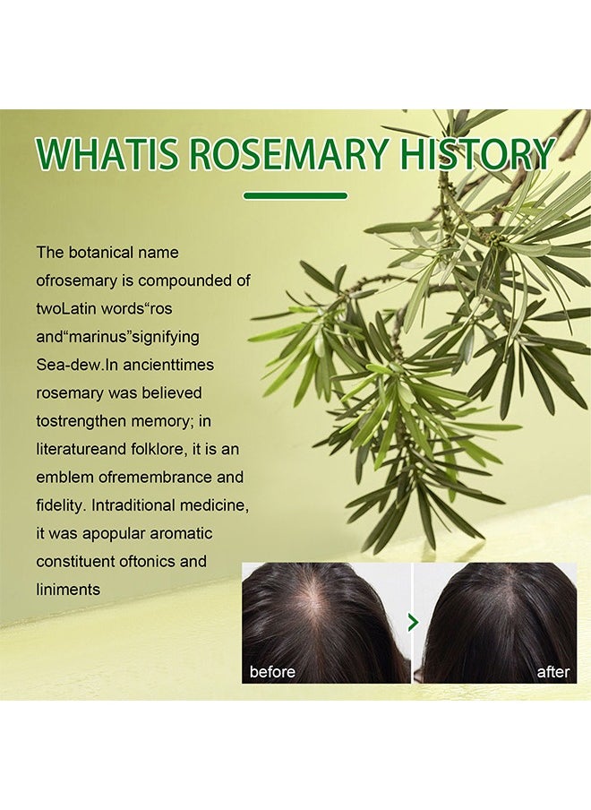 EELHOE - Rosemary Mint Scalp& Hair Strengthening Oil,Stop Hair Loss Hair, Thinning Treatment Hair Growth Oil for Women & Men 60ml - Image 1