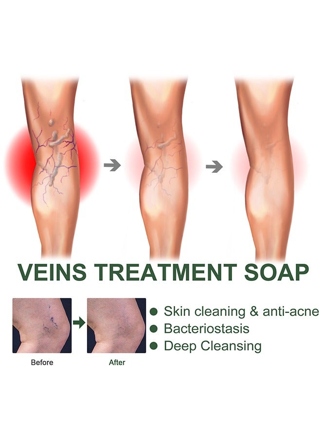 EELHOE Veinopro Varicose Veins Treatment Soap, Removal Spider Veins Treatment For Legs Healing Wormwood Formula, Anti Varicose Vein Soothing Leg Soap, Improve Blood Circulatio Quickly Soothing Swelling 100G - Image 5