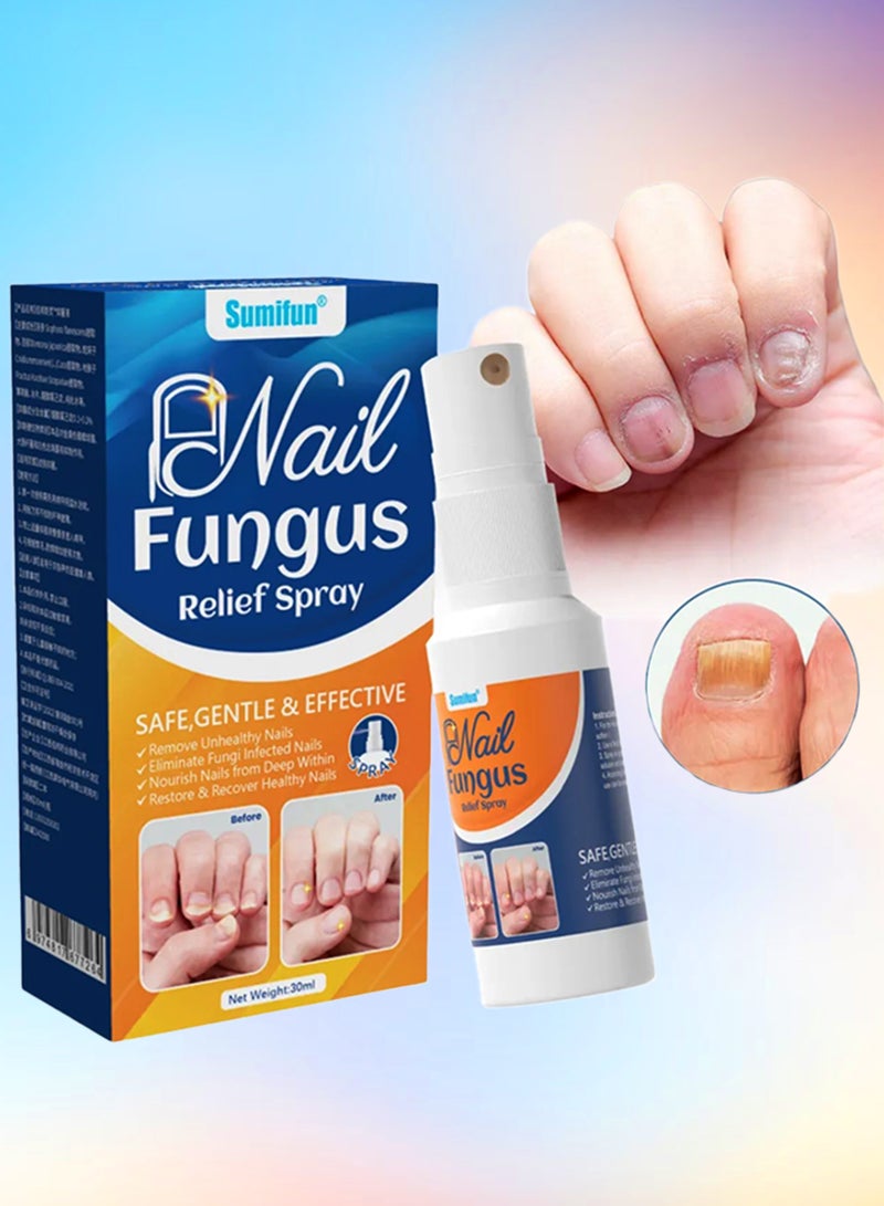 Sumifun بخاخ تخفيف فطريات الأظافر لتجديد الأظافر اليدوية والقدمية، إصلاح مضاد للفطريات، تنعيم وترطيب الأظافر، تغذية واستعادة الأظافر الصحية، بخاخ علاج فطريات الأظافر 30 مل - Image 1