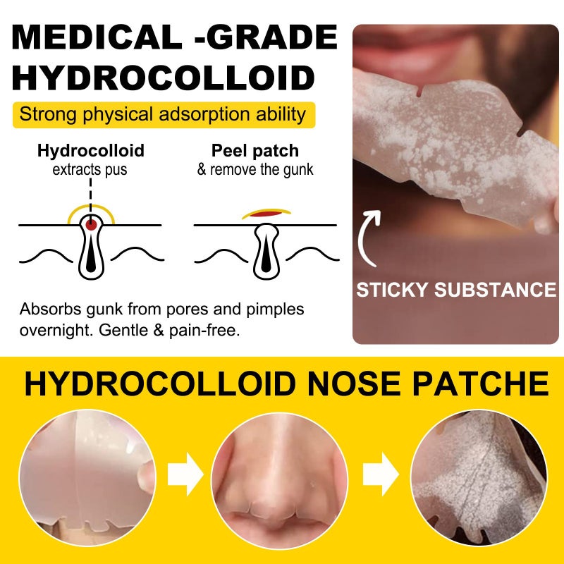 ELAIMEI Water Colloid Blackhead Removal Nose Strips for Pore Cleansing, Gentle on Skin, 12pcs - Image 2