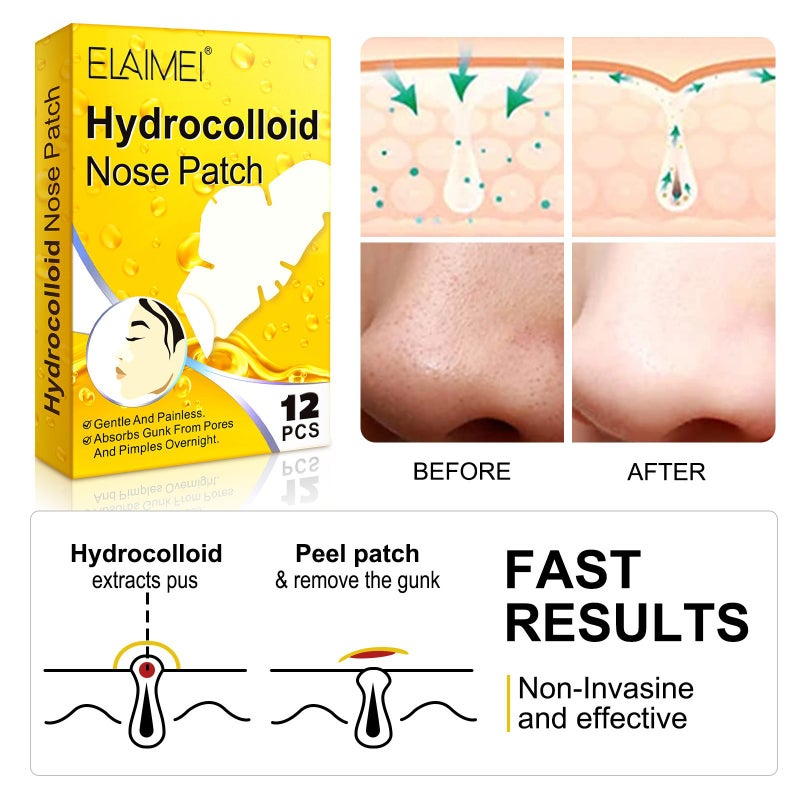 ELAIMEI Water Colloid Blackhead Removal Nose Strips for Pore Cleansing, Gentle on Skin, 12pcs - Image 1