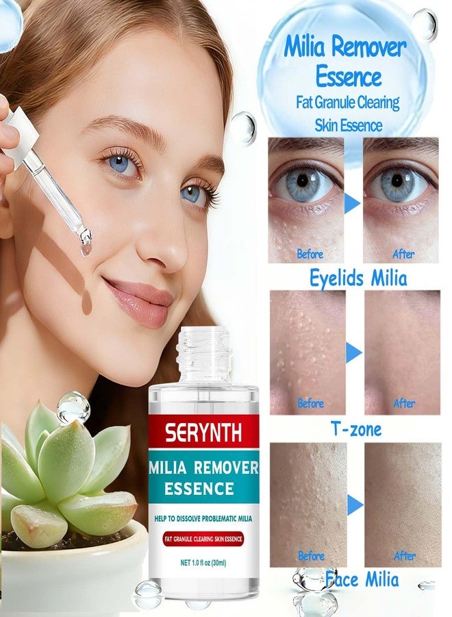 SERYNTH Milia Remover Essence for Eyelids & Face, 30ml - Image 2
