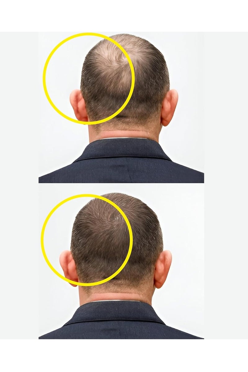 Masofta Hair Growth Serum For Promoting Hair Growth & Controlling Hair Fall With 3% Redensyl, 5% Capixyl, 4% Anagain, 3% Procapil & 3% Baicapil, Rosemary & Biotin, For Both Men & Women, 30ML - Image 2