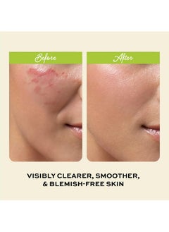 The Natural And Organic Family Clarifying Toner for Face - Salicylic Acid Toner - Spot and Oil Control, Cruelty-Free Skincare by The Natural and Organic Family - 7.04 oz  - Image 4