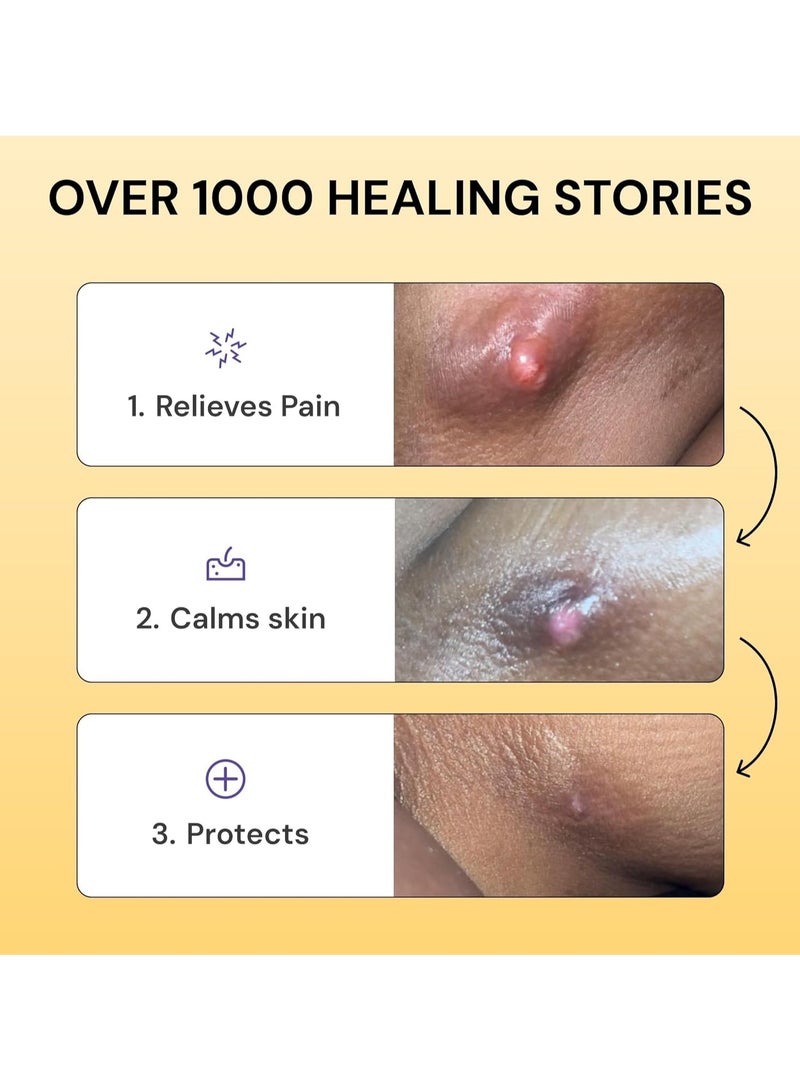 LANISKA Universal Flare Care | Relief for 97% of Skin Issues | Cysts, Inflamed Skin, Hidradenitis Suppurativa, Abscesses, Impetigo | All Natural Flare Up Solution With Propolis & Egg Yolk Extract 1.76 oz - Image 3