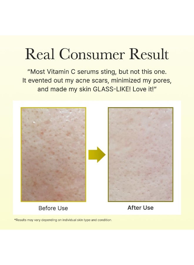 Arencia Vitamin C Booster Serum with Glutathione, Niacinamide and Vitamin E for Glow Skin 1.01 fl oz - Image 5