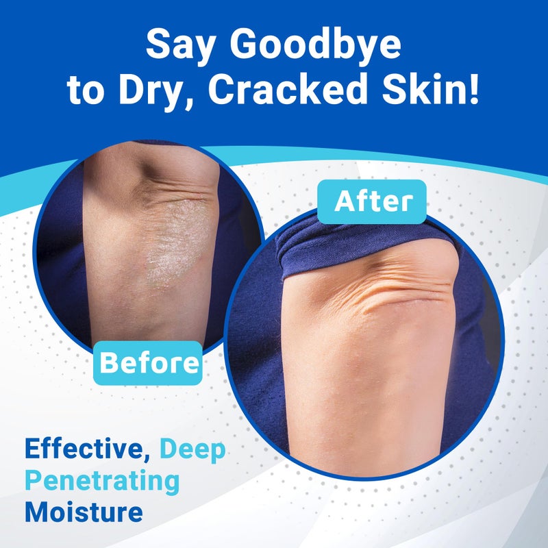 dermal therapy كريم ديرمال ثيرابي لليد والمرفق والركبة مع 15% يوريا و6% AHA - يرطب ويقشر بعمق البشرة الجافة والمتشققة على اليدين والمرفقين والركبتين - خالي من العطور، غير دهني - 3.5 أونصة سائلة / 100 مل - Image 3