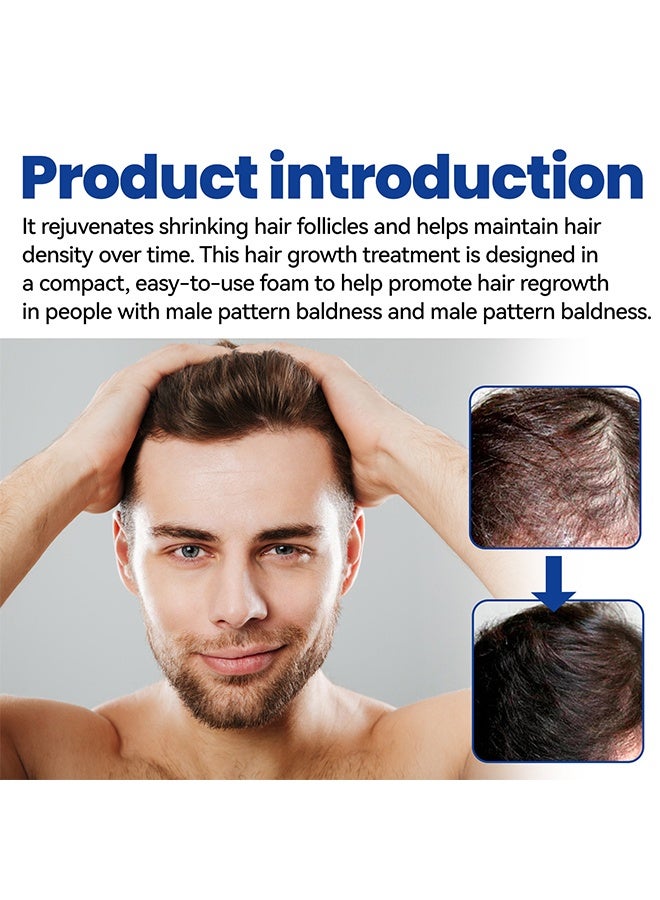 إيست مون رغوة مينوكسيديل 5٪ لنمو الشعر للرجال، لمحاربة تساقط الشعر، وترقق الشعر، وتراجع خط الشعر، يعزز لحية وشعر أكثر كثافة، يساعد على منع الترقق، ويكثف الشعر ليصبح أكثر امتلاءً، غير دهنية - 60 مل - Image 5