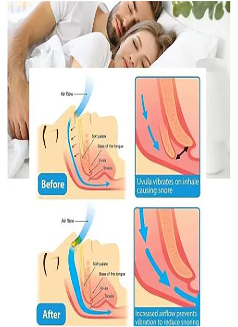 Dada - Anti Snoring Device, Easy Breath, For Better Nose Breathing, Improve Nighttime Sleeping, Less Mouth Breathing, Advanced Design, Reusable - Image 1