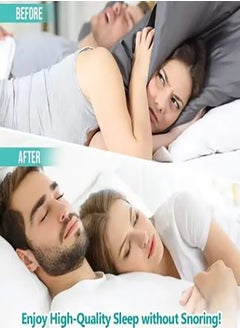Dada Anti Snoring Device, Easy Breath, For Better Nose Breathing, Improve Nighttime Sleeping, Less Mouth Breathing, Advanced Design, Reusable  - Image 5
