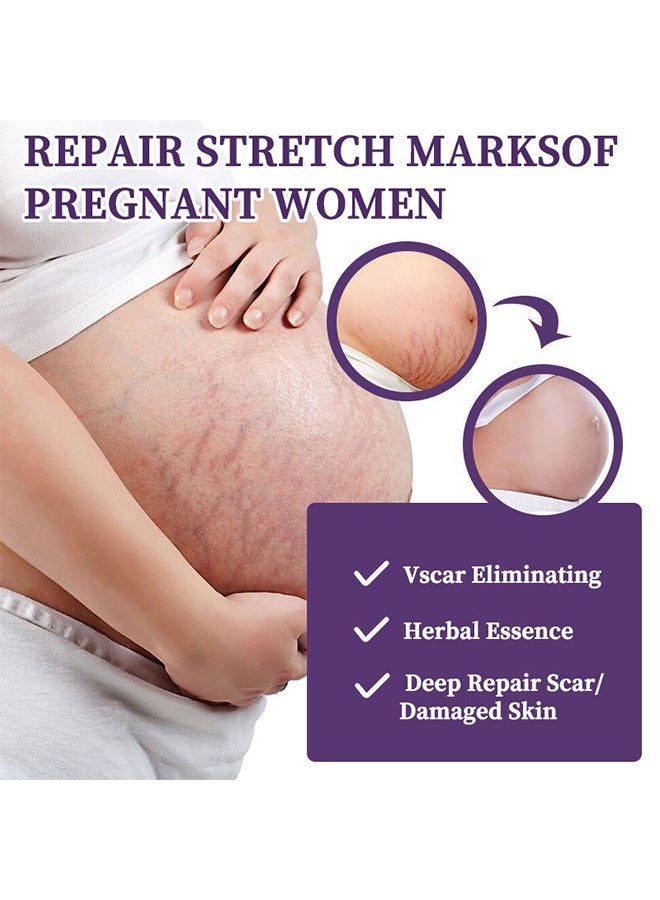 HBESTY Silicone Scar Gel, Skin Scar Cream，Body Scar Removal, Scar Cream，Scar Gel，Acne Scar Treatment，Deep Acne Scar Removal， Burns Keloids Hypertrophic， Scar Removal Cream， Repair Damaged Skin，Removing Acne Marks, Scar Repair Cream - Image 2