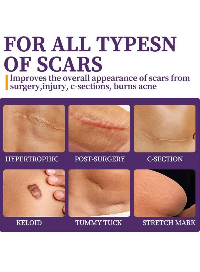 HBESTY Silicone Scar Gel, Skin Scar Cream，Body Scar Removal, Scar Cream，Scar Gel，Acne Scar Treatment，Deep Acne Scar Removal， Burns Keloids Hypertrophic， Scar Removal Cream， Repair Damaged Skin，Removing Acne Marks, Scar Repair Cream - Image 4