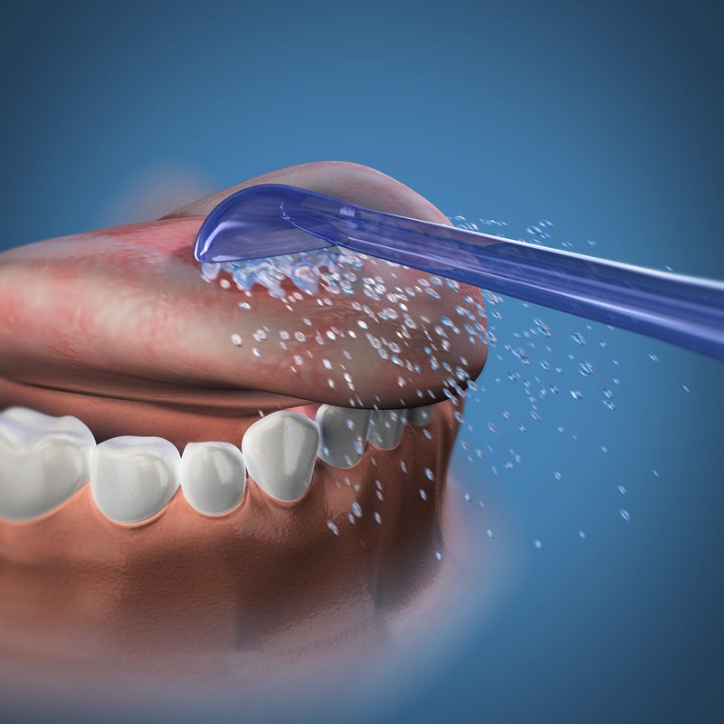 Waterpik Genuine Replacement Tongue Cleaner Tip, Water Flosser Refill Heads Nozzles, Reduce Bad Breath, Improve Oral Hygiene, TC-100E, 2 Count (Assorted Colors) - Image 4