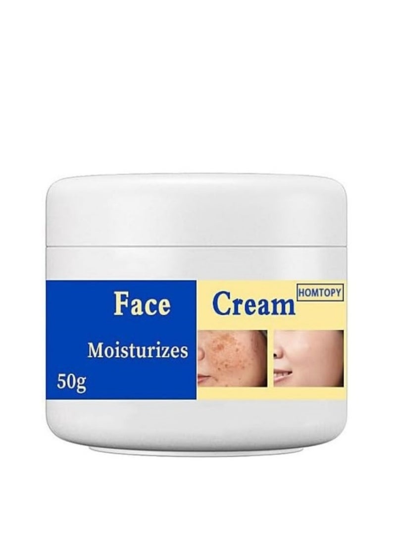HOMTOPY مزيل البقع الداكنة للوجه، علاج الكلف، مصحح فرط التصبغ، كريم للبقع مع فيتامين C والجلسرين، يخفف بقع الشمس والنمش للحصول على لون بشرة متساوي 50 جرام - Image 1