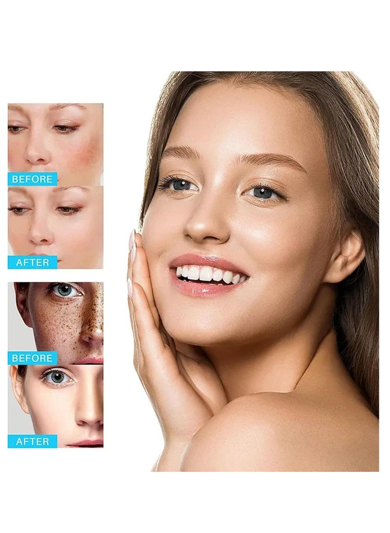 HOMTOPY مزيل البقع الداكنة للوجه، علاج الكلف، مصحح فرط التصبغ، كريم للبقع مع فيتامين C والجلسرين، يخفف بقع الشمس والنمش للحصول على لون بشرة متساوي 50 جرام - Image 5