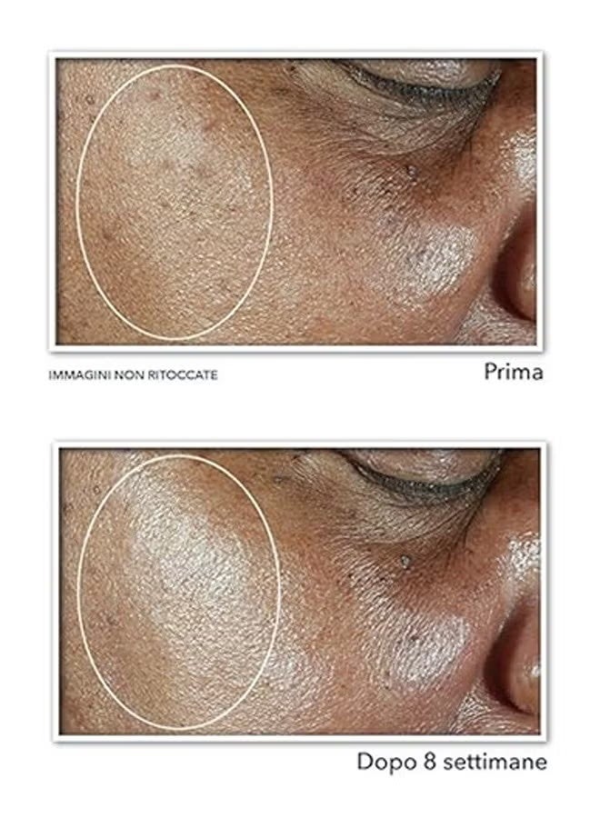 روك سيروم متعدد التصحيح لتوحيد لون البشرة ورفعها، خلاصة إصلاح الوجه، إزالة لطيفة للبشرة الباهتة غير المتساوية، خلاصة تلاشي الخطوط الدقيقة في الوجه - 30 مل - Image 2