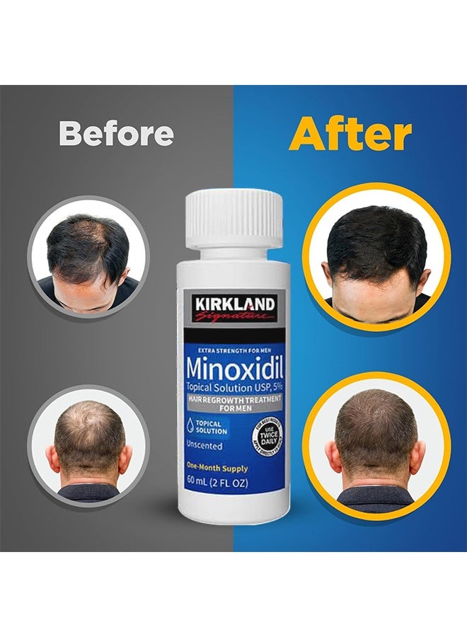 Kirkland Signature 6 Pieces Minoxidil Topical Solution USP, 5%, Extra Strength Hair Regrowth Treatment For Men - Image 2