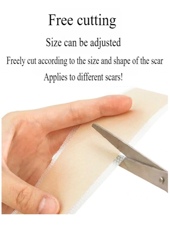 Silicone Scar Tape, Medical Silicone Scar Removal Sheet, Stretch Mark Treatment Waterproof Silicone Scar Sheet, Fade Scar Effective Cosmetic Scar Removal Gel Painless Tape Roll for Cesarean Section, Burn Scars and Other Scars (4cm x 1.5m) - Image 5