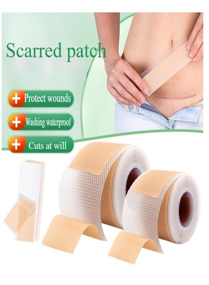 Silicone Scar Tape, Medical Silicone Scar Removal Sheet, Stretch Mark Treatment Waterproof Silicone Scar Sheet, Fade Scar Effective Cosmetic Scar Removal Gel Painless Tape Roll for Cesarean Section, Burn Scars and Other Scars (4cm x 1.5m) - Image 1