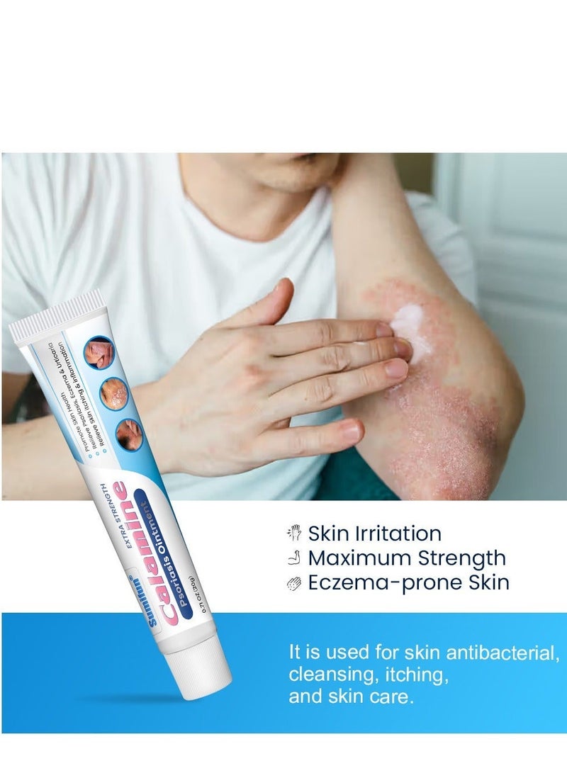 Sumifun Extra Strength Calamine Psoriasis Ointment, Promote Skin Health Relieve Psoriasis, Eczema and Urticaria Relieve Skin Itching & Inflammation 20g - Image 5
