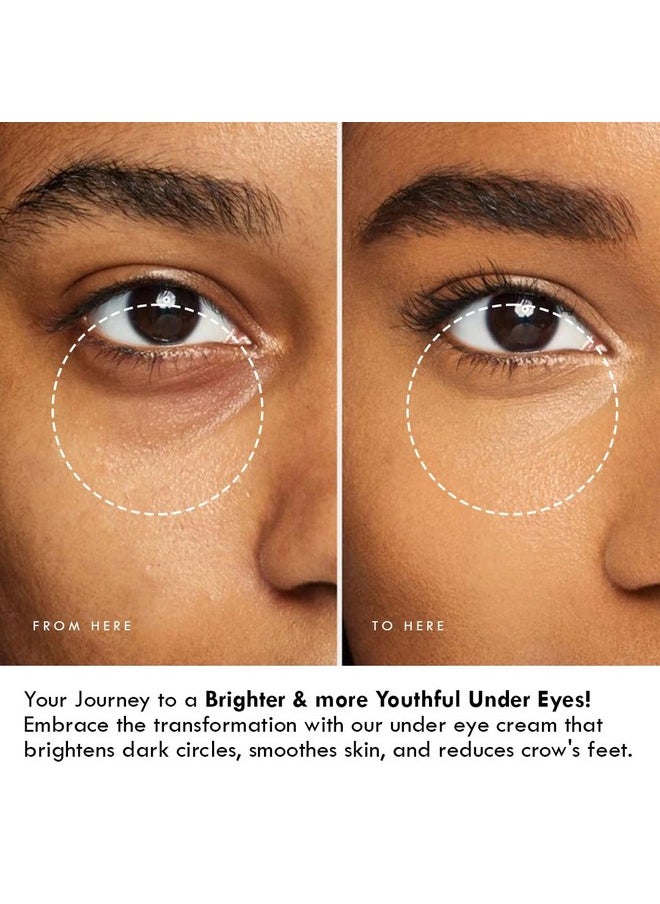AULI LIFESTYLE - Auli Age -Defying Under-Eye Cream For All Skin Types, Hydrates, Reduces Dark Circles And Pigmentation For Bright, Clear, And Even Undereyes - Eyes And Shine+ - 30 Gm - Image 1