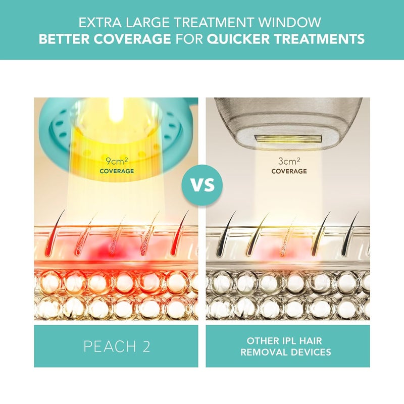 FOREO PEACH 2 IPL Hair Removal Device Quick Gentle Hair Reduction For Full Body Face Skin Cooling System Silicone Shield Artic Blue - Image 3