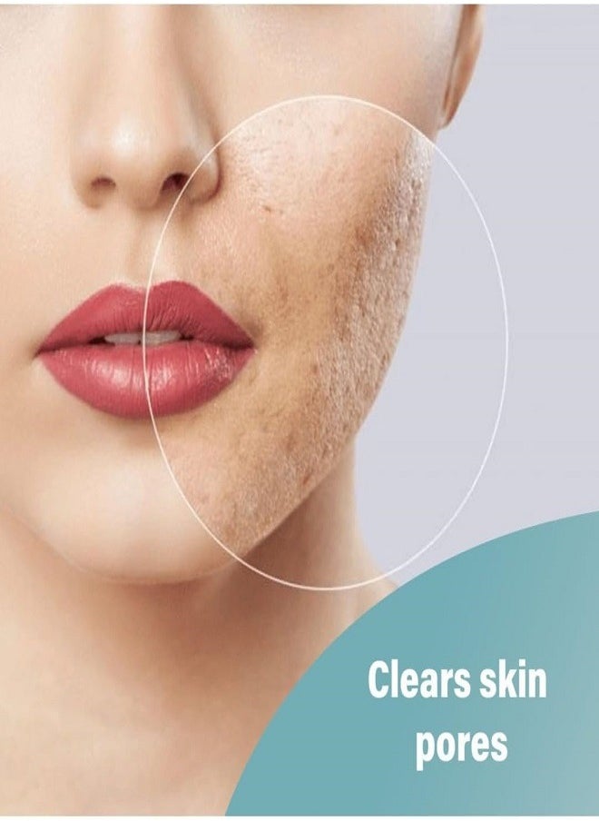 Medpharma - A Ret Tretinoin Cream 30g - Image 1