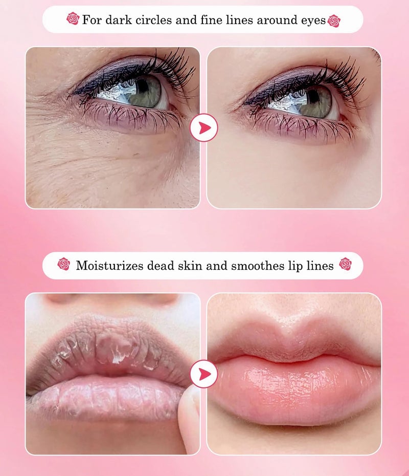 YMEYFAN 10 Pair Under Eye Mask & 10 Pair Lip Mask Skincare Set, Rose Pink Lip Patches & Under Eye Patches for Puffy Eyes, Dark Circles, Dry Lips Lines, Deep Hydrating Moisturizing, Gifts for Mom Women - Image 4