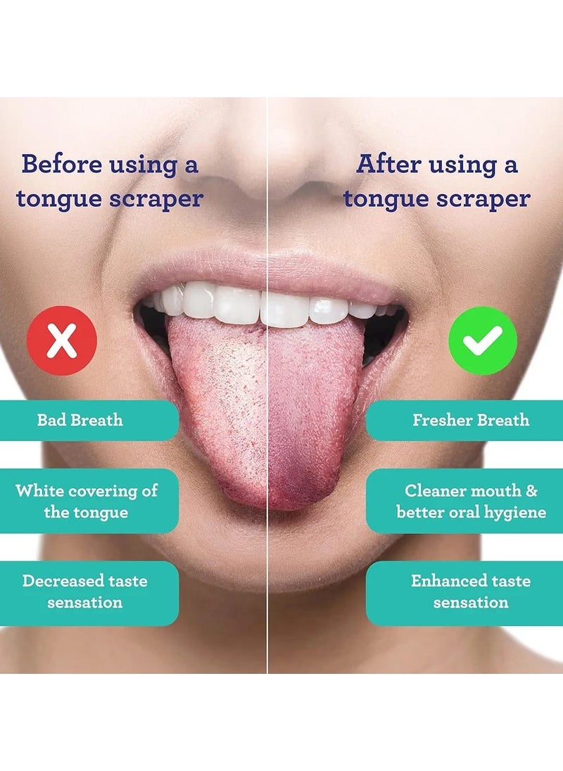 GuruNanda Tongue Scraper (Pack of 2), Stainless Steel Tongue Scraper for Oral Hygiene, Bad Breath Treatment, Medical Grade 100% Stainless Steel Tongue Cleaner with Travel Case for Adults & Kids  - Image 3