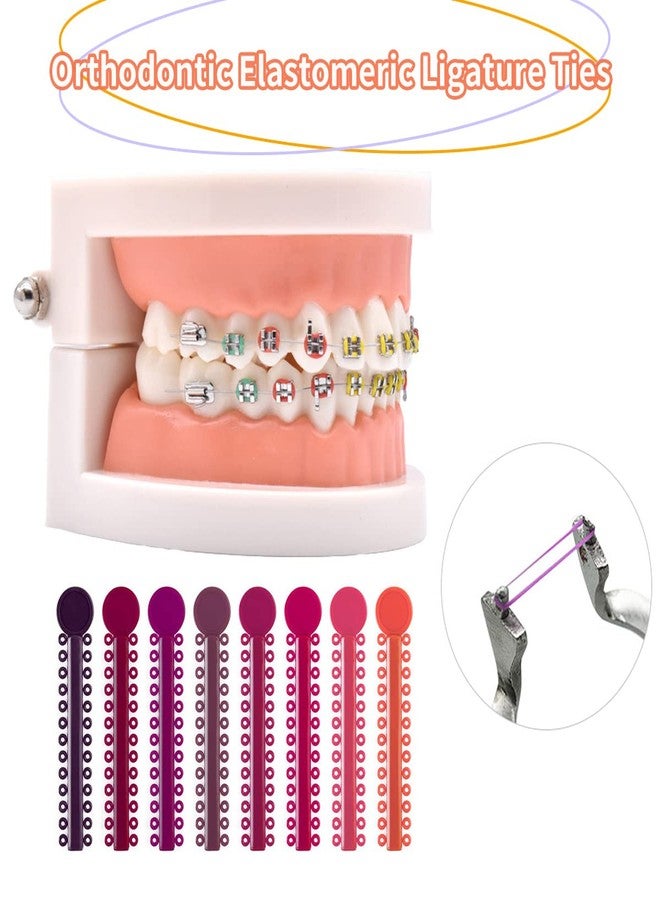 Ceonam 1040 Pcs Multicolored Braces Rubber Bands Orthodontic Ligature Ties O-Rings Elastic Bands for Braces (Color - Image 4